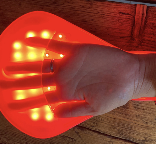 Hand treatment with red light LED therapy device